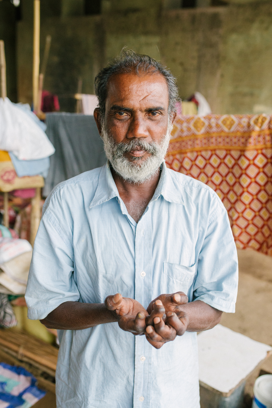 An elderly man shows the effects of a late diagnosis of leprosy: clawed hands and numb feet at risk from the slightest of wounds.  He dreams of a different future for the children.